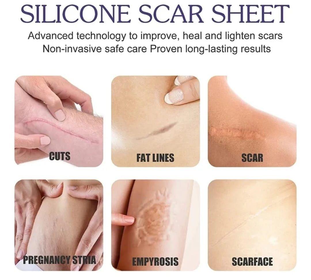 Parche de Silicona  para Cicatrices y Queloides rollo 4cmx1,5metros-2