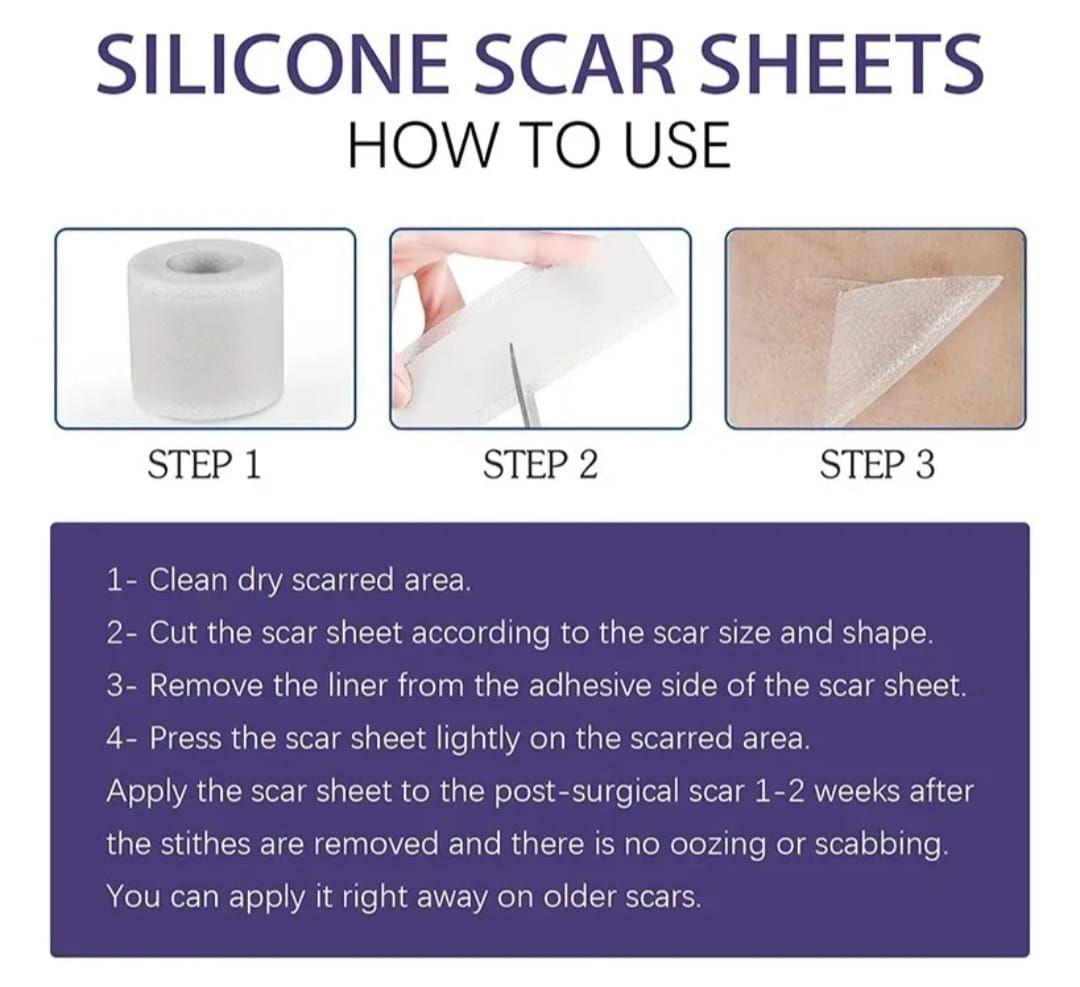 Parche de Silicona  para Cicatrices y Queloides rollo 4cmx1,5metros-3
