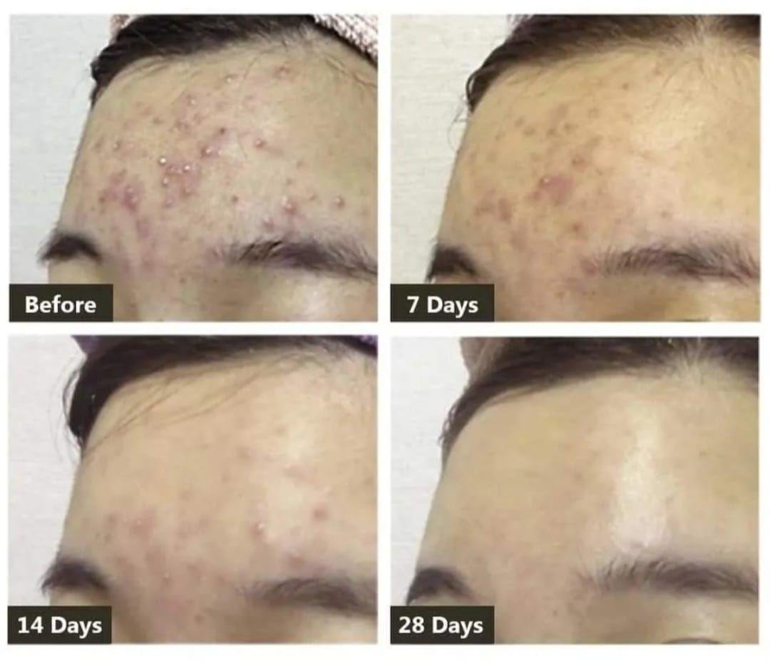 Gel Aloe Vera Hidratante Calmante 300ml-2