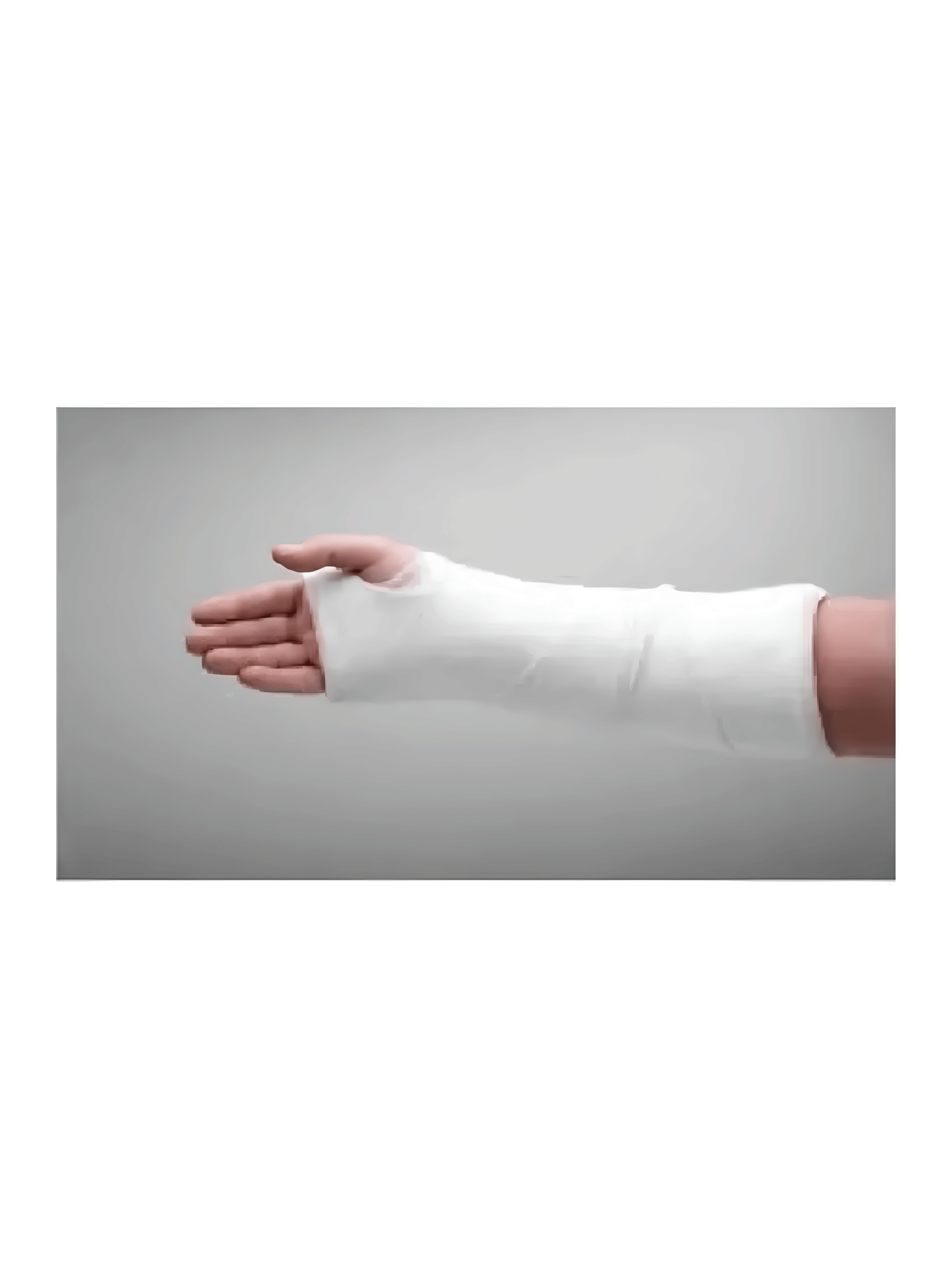 Vendas De Yeso 7 5 Cm X 2 7 Mt Yesoterapia Lesiones Listas-4