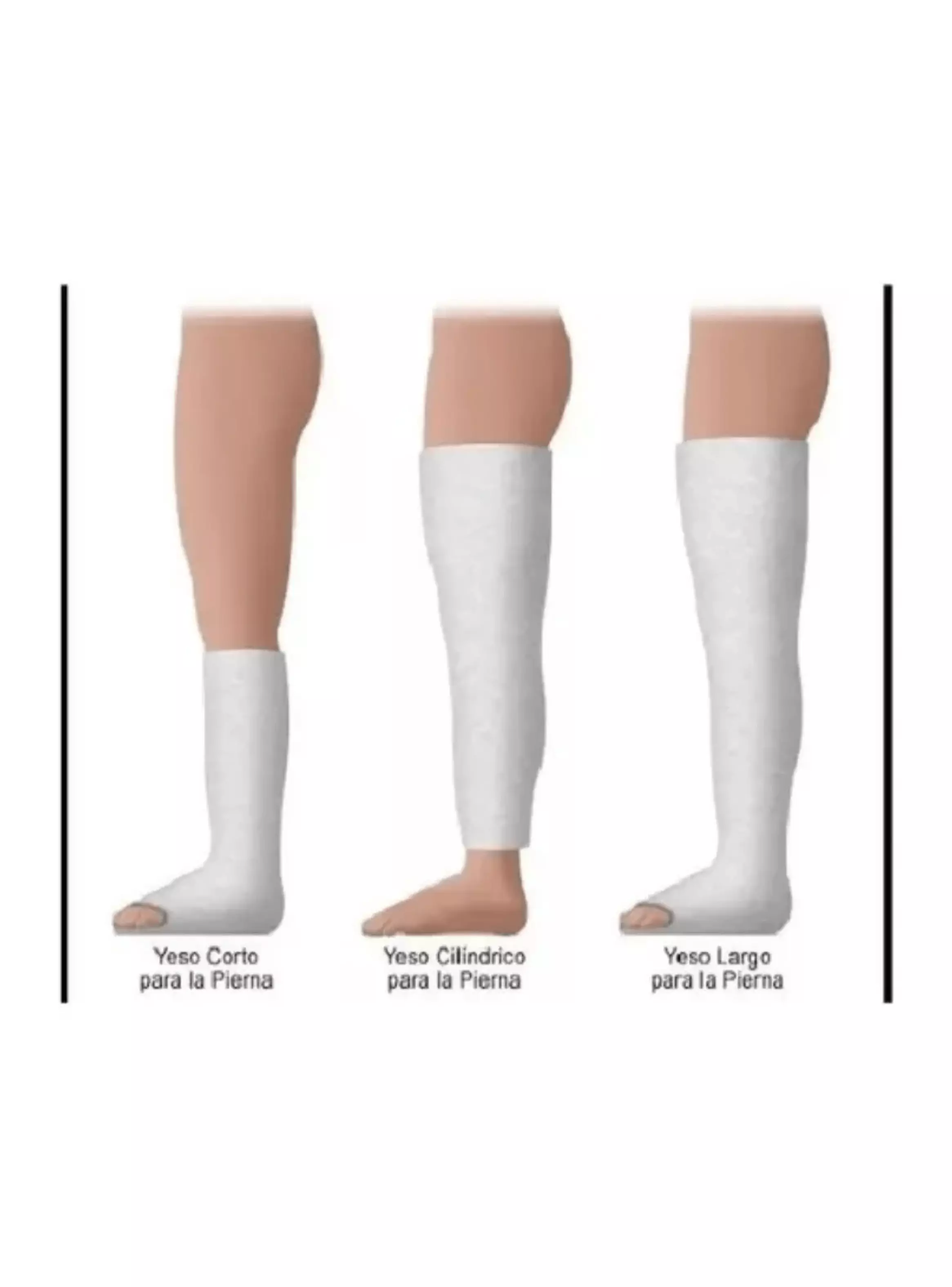 Venda Yeso 10cm X 3mt Lesiones Yesoterapia Manualidaes-2