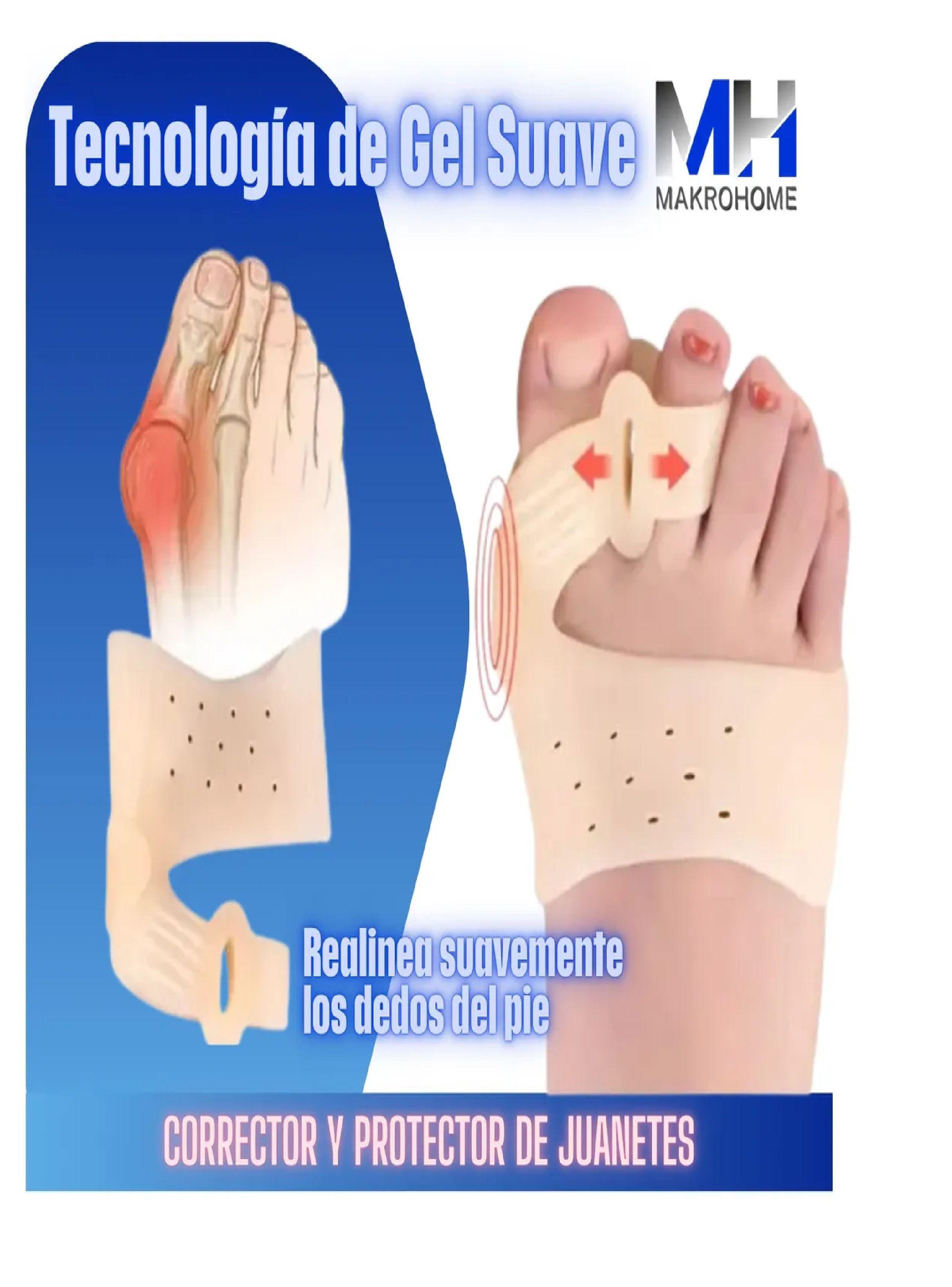 Separador Corrector Juanetes Metatarsal Dedos Pie Con Iman-2