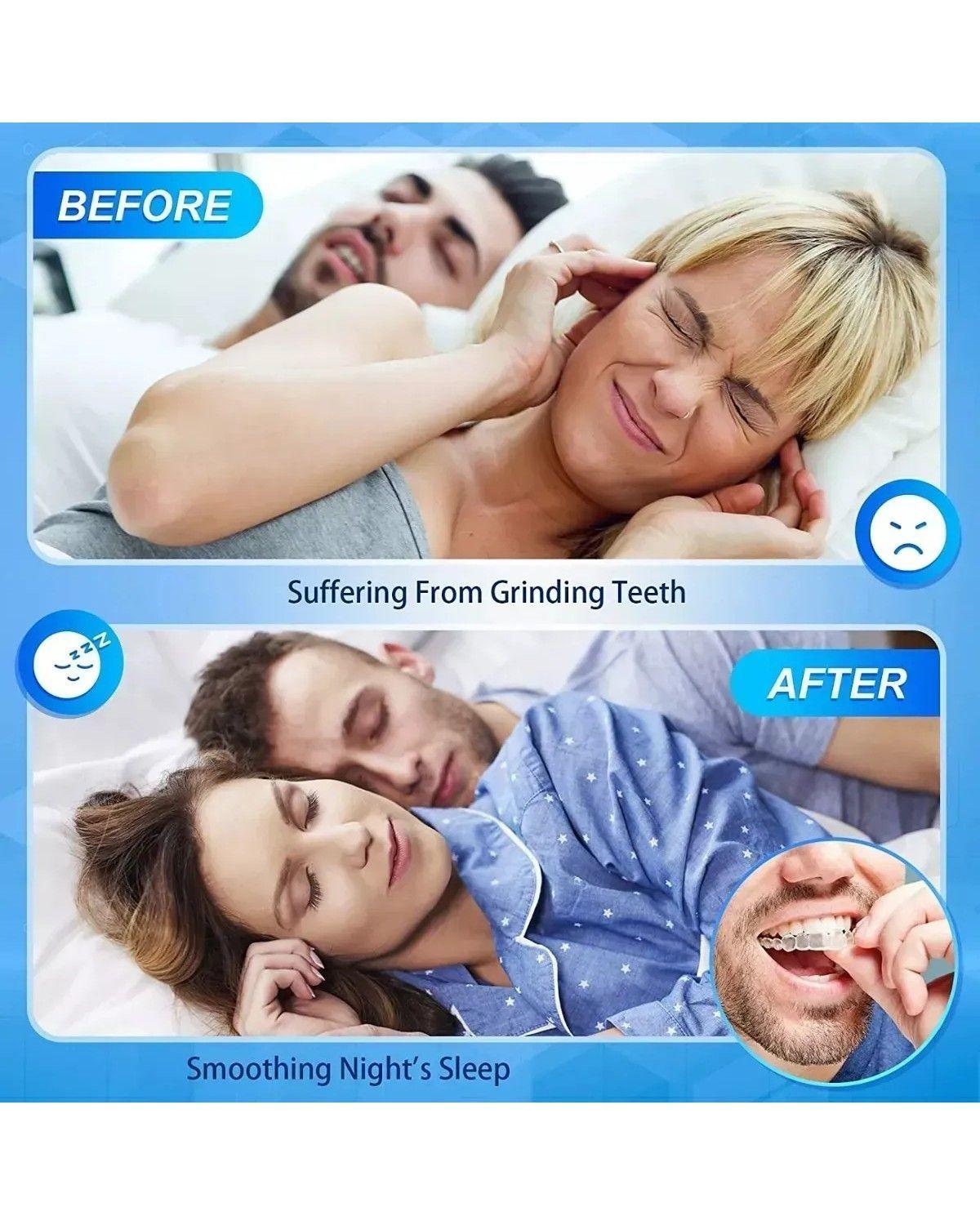 Set 4 Guarda Dental Moldeable Desgaste Bucal Anti Bruxismo-2