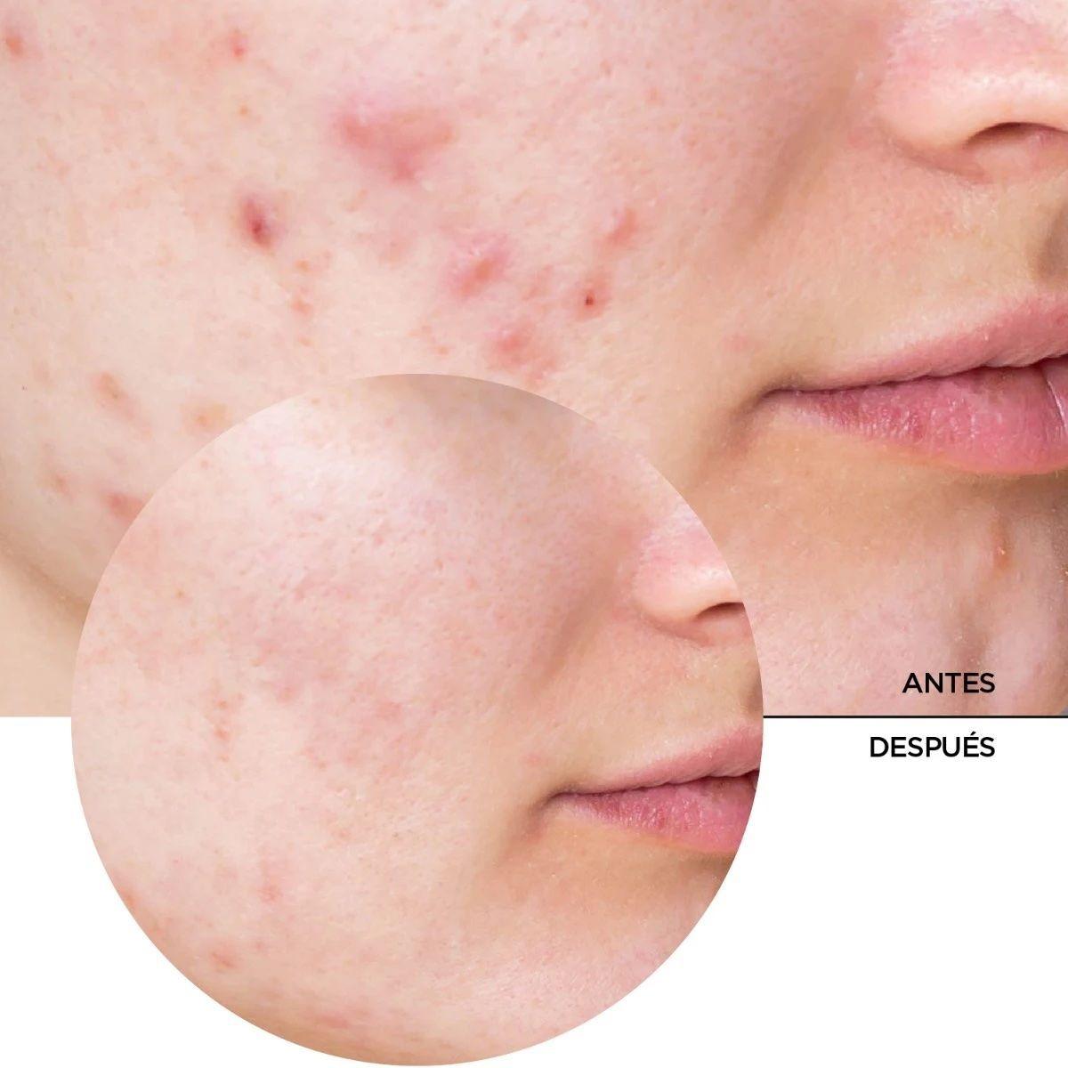 REVOX B77 Niacinamida 10% - Just Niacinamide 10% 30 Ml-2