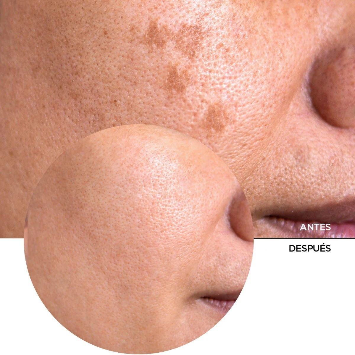 REVOX Vitamina C 20% - Just Vitamin C 20% 30 Ml-2