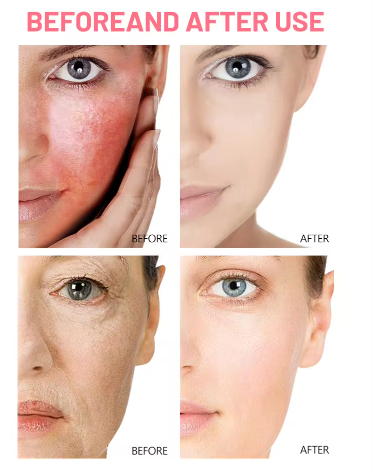 Serum De Rosas Con Acido Hialuronico-3