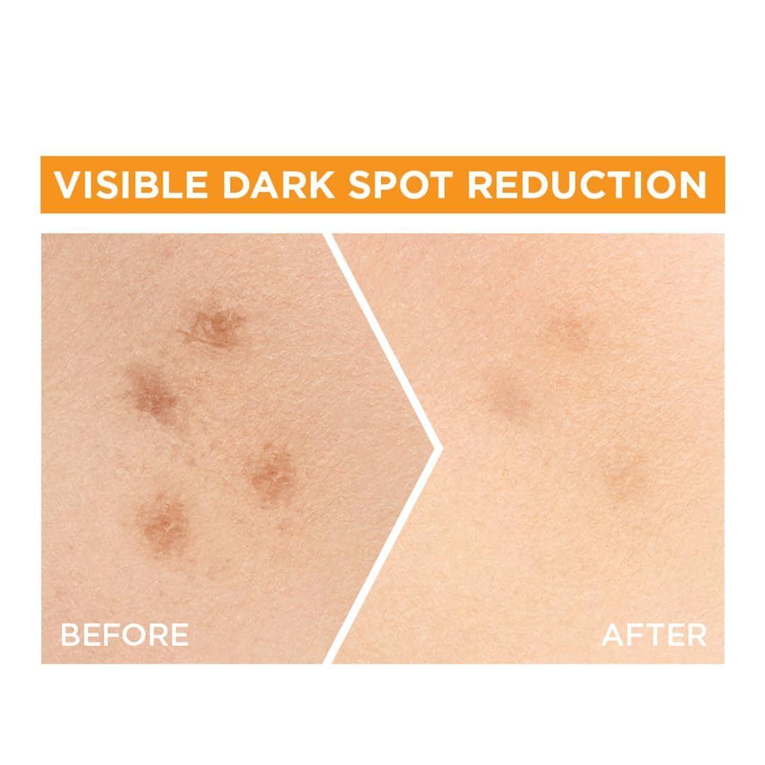 Garnier Bright Complete Suero Nicotinamida 30x Vitamina C-5