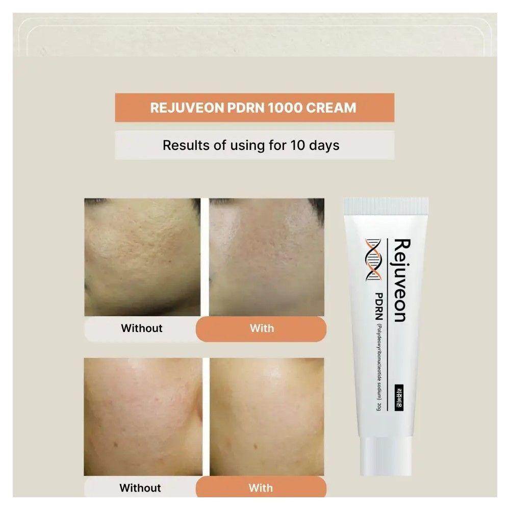 Crema Facial Rejuveon Pdrn1000plus Polidesoxirribonucleótido Todo Tipo De Piel Noche-2