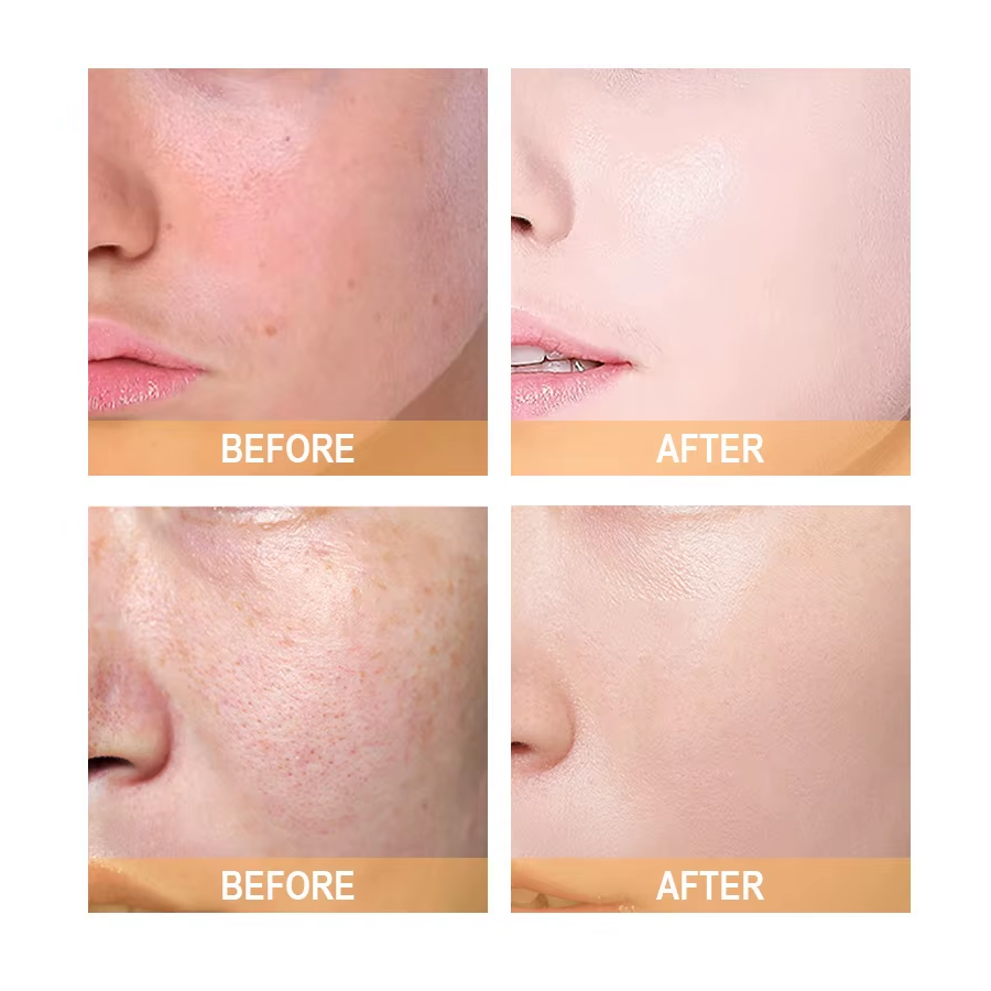 Glycolic Acid 7% Solucion Acido Glicolico Tonificante 240ml-6