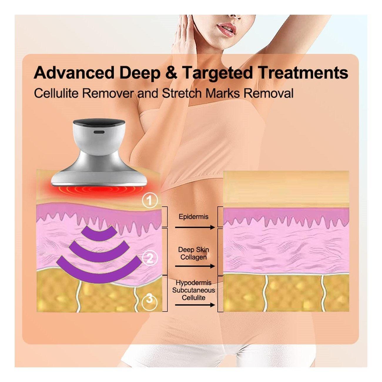 Celluslim Masajeador Profesional Celulitis Calor Infrarrojo-4