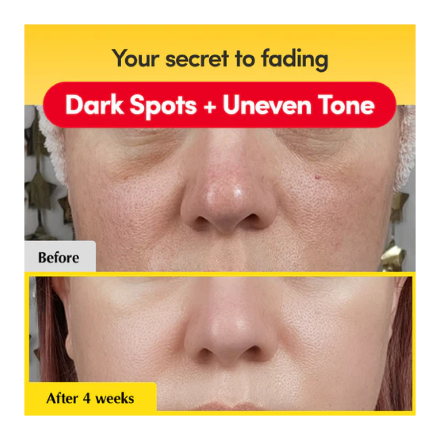 Eqqualberry Vitamin Illuminating Serum Iluminador Facial 30ml-3