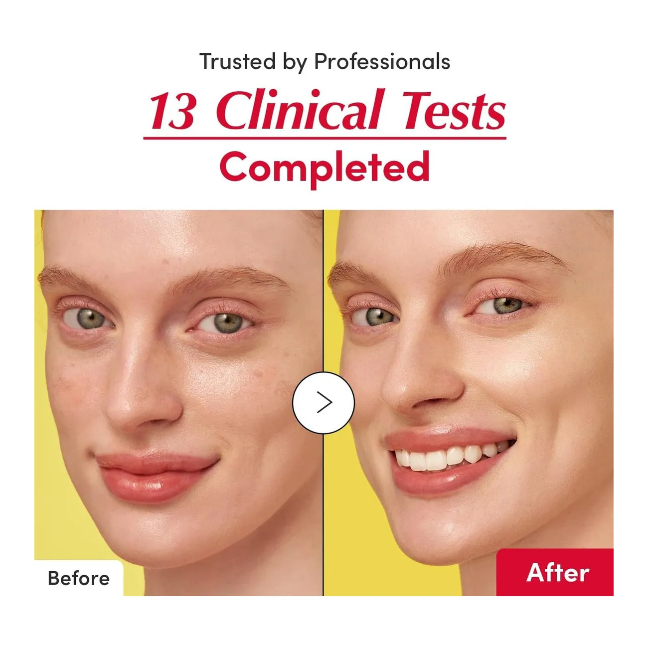 Eqqualberry Vitamin Illuminating Serum Iluminador Facial 30ml-4