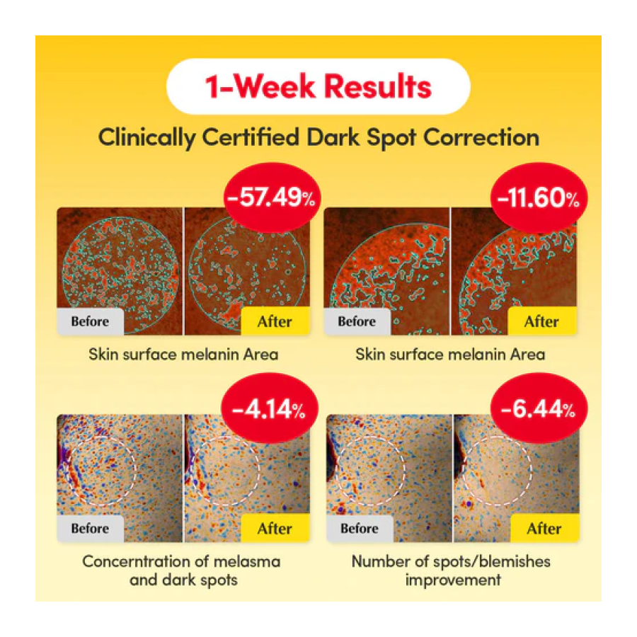 Eqqualberry Vitamin Illuminating Serum Iluminador Facial 30ml-5