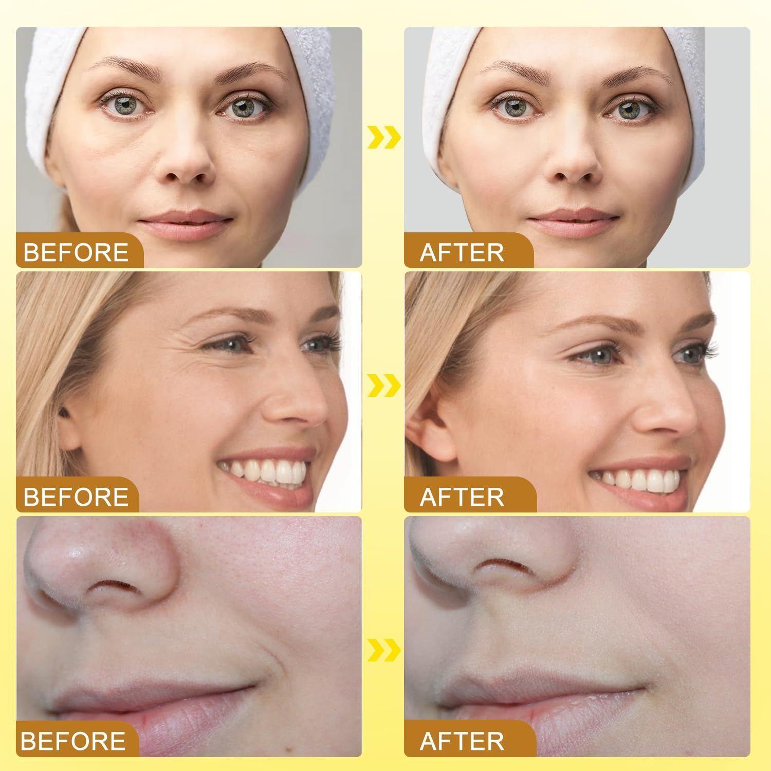 Botox Bee Venom Crema Colageno Facial Efecto Lifting 20gr-5