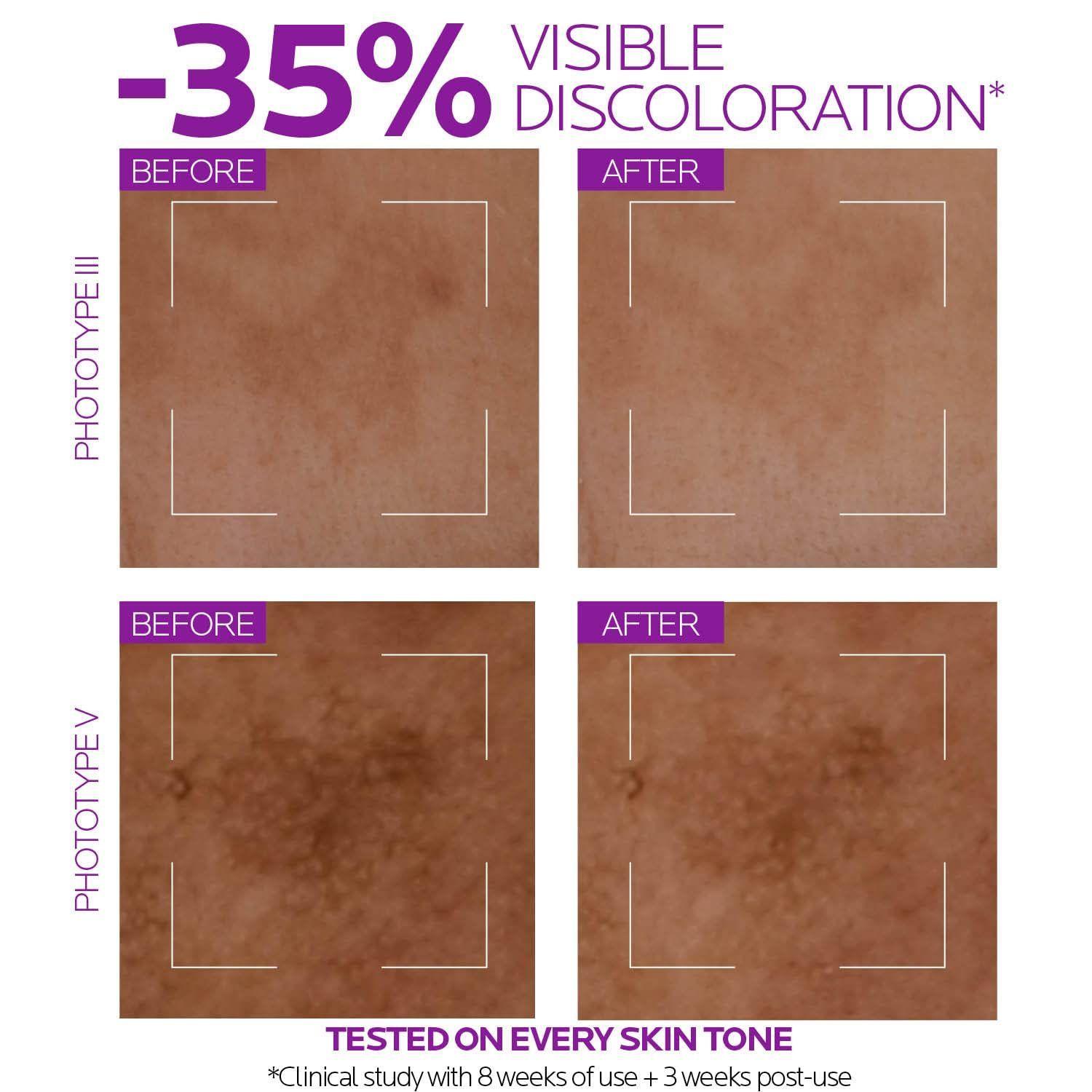 Serum La Roche Posay Pure Niacinamide 10 Anti Envejecimiento-5