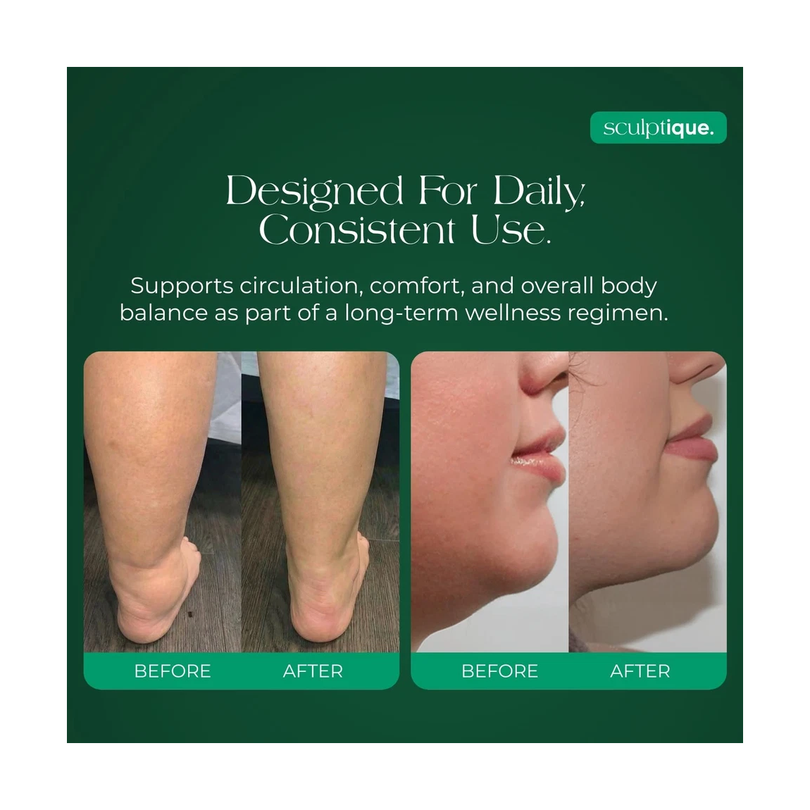 Suplemento Drenaje Linfatico Hinchazon Celulitis Detox 60u-2