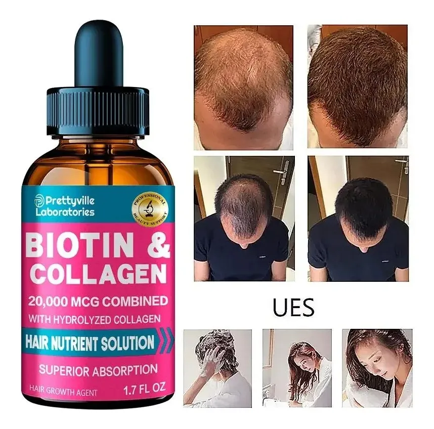 Serum Biotina Y Colageno Crecimiento Del Cabello Prettyville-5