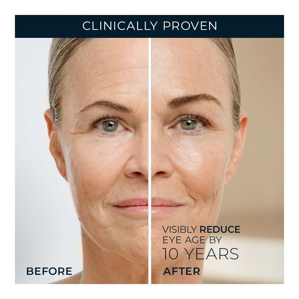 Roc Retinol Correxion Line Smoothing Eye Cream Crema De Ojos-5