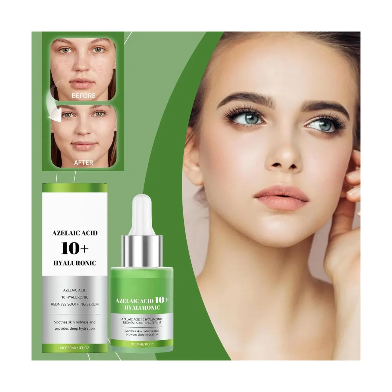 Serum Facial Antiacne Acido Azelaico 10% + Hialuronico 30ml-2