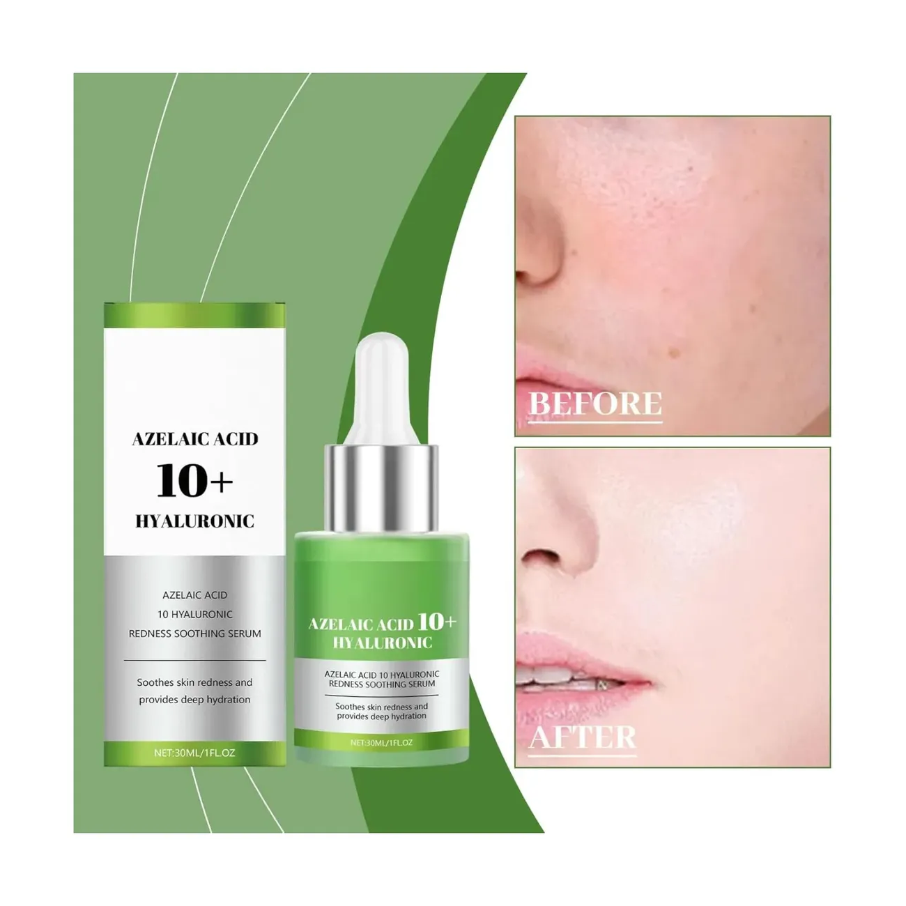 Serum Facial Antiacne Acido Azelaico 10% + Hialuronico 30ml-4