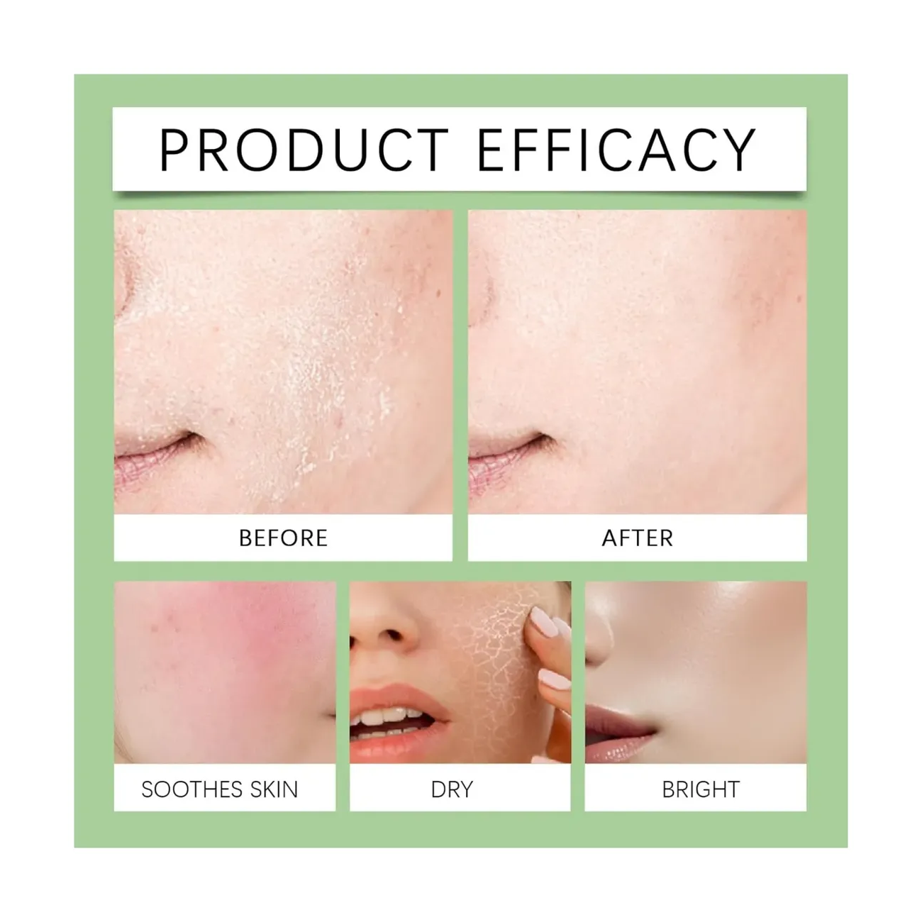 Serum Facial Antiacne Acido Azelaico 10% + Hialuronico 30ml-7