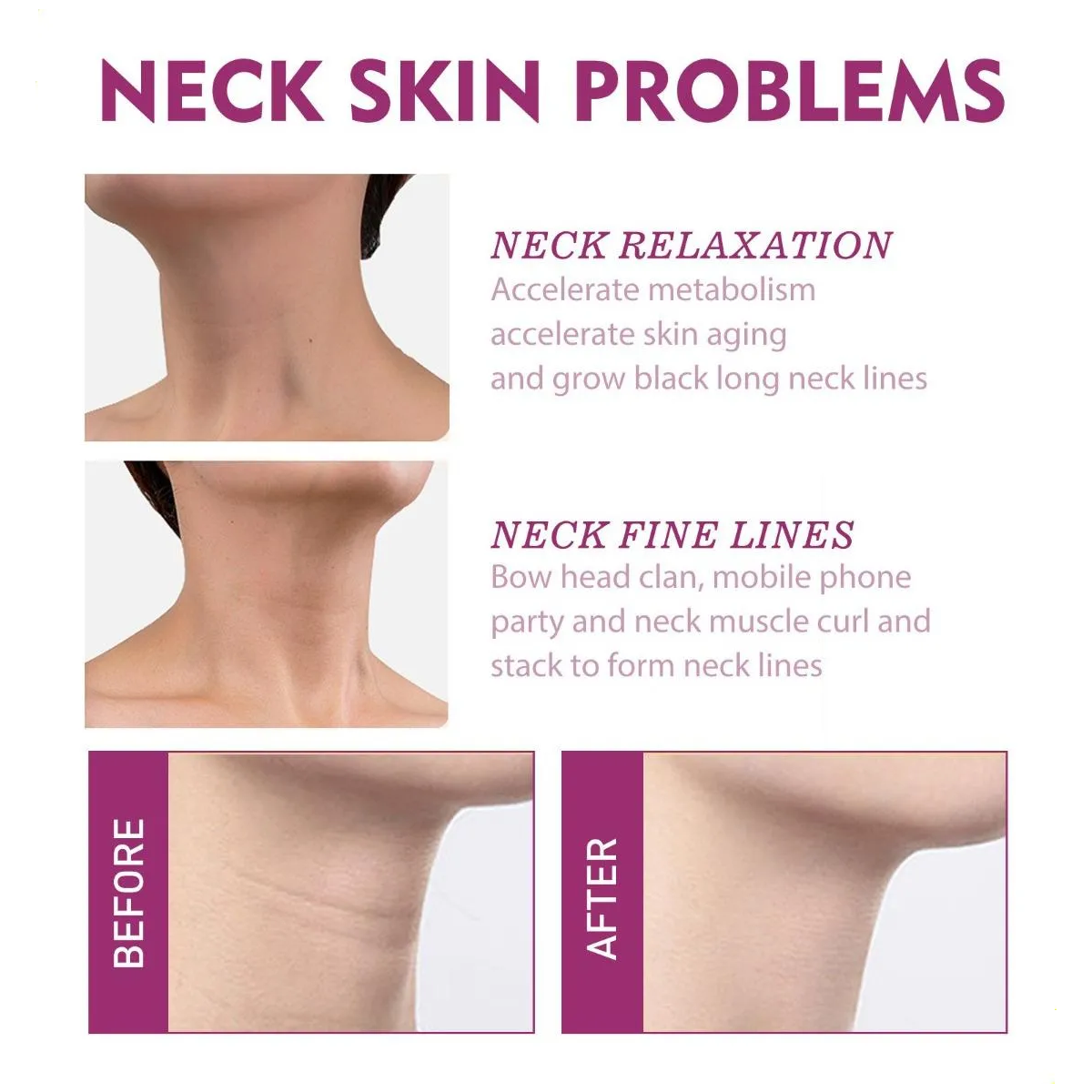Crema Neckpon Reafirmante Colageno Hidrolizado Para Cuello Escote 40g-4