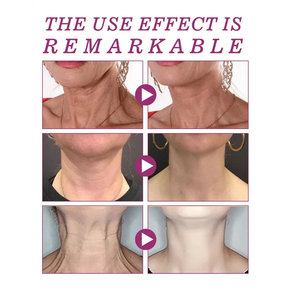 Crema Neckpon Reafirmante Colageno Hidrolizado Para Cuello Escote 40g-7