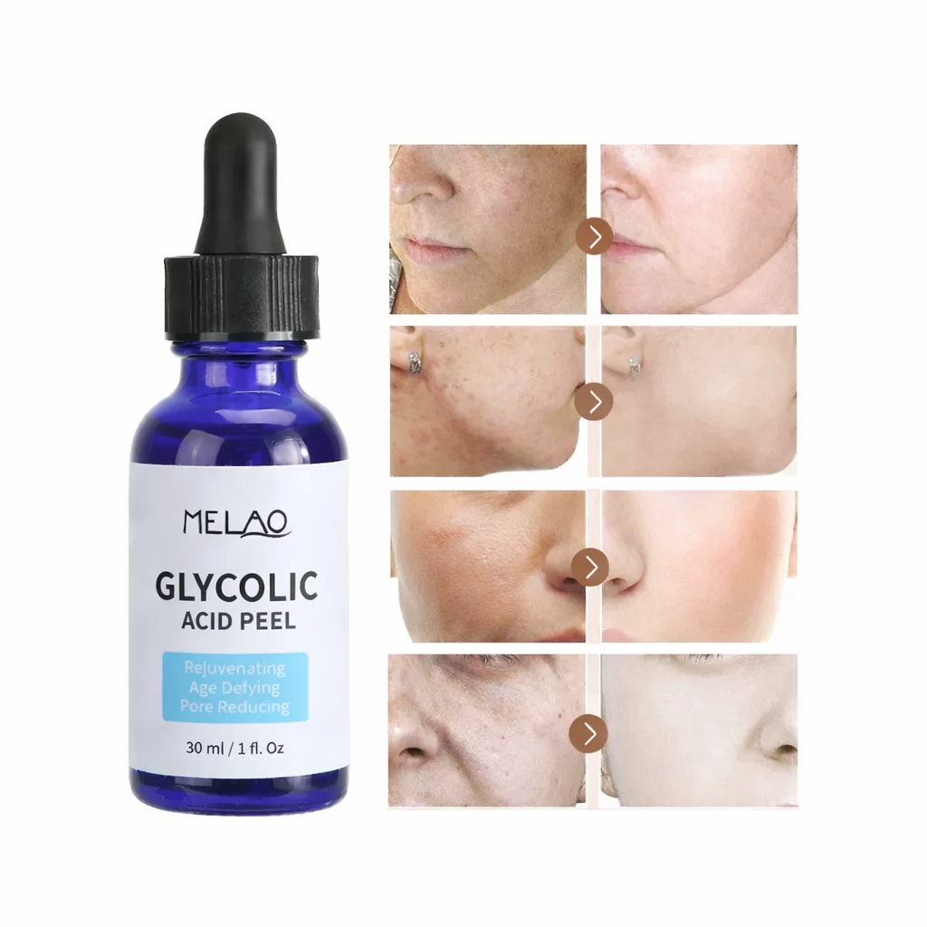 Melao Serum Ácido Glicólico 70% 30ml Peeling Normal A Mixta Noche -4