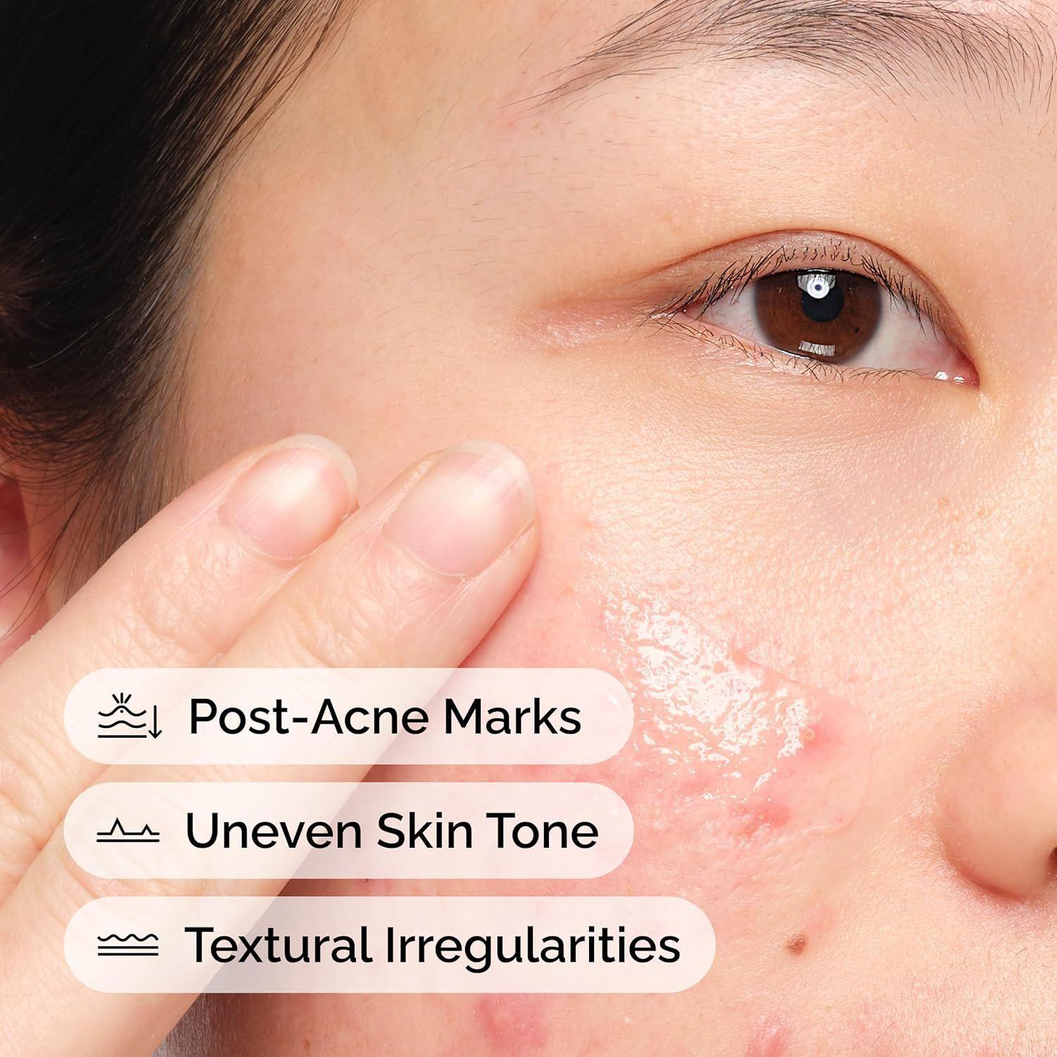 The Ordinary Aloe 2% + Nag 2% Serum Calmante Manchas 30ml-3