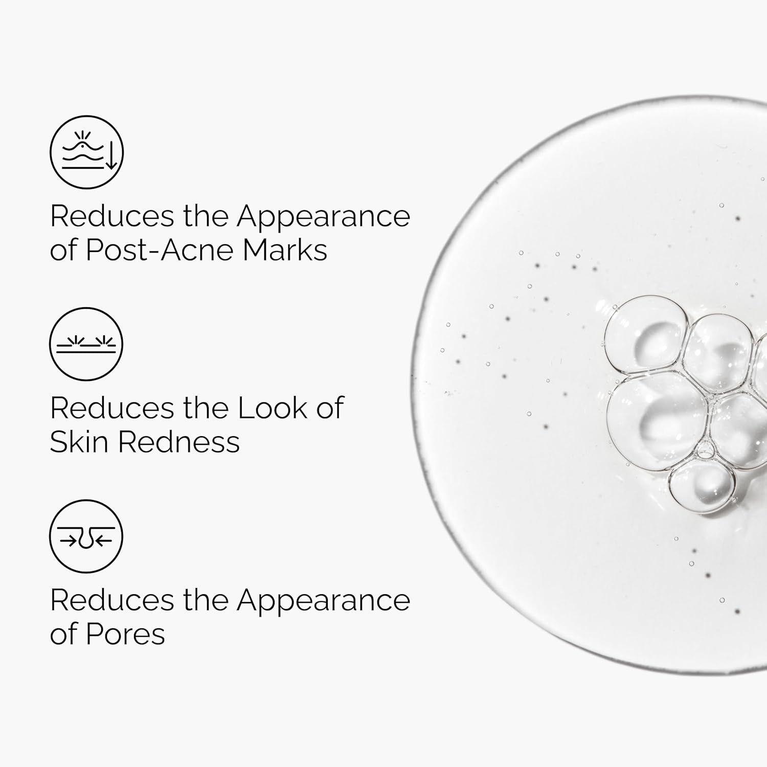 The Ordinary Aloe 2% + Nag 2% Serum Calmante Manchas 30ml-4