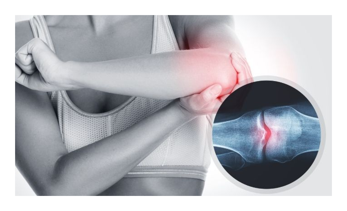 Finartrit Glucosamina Condoitrina En Polvo 30 Sobres Naranja-2