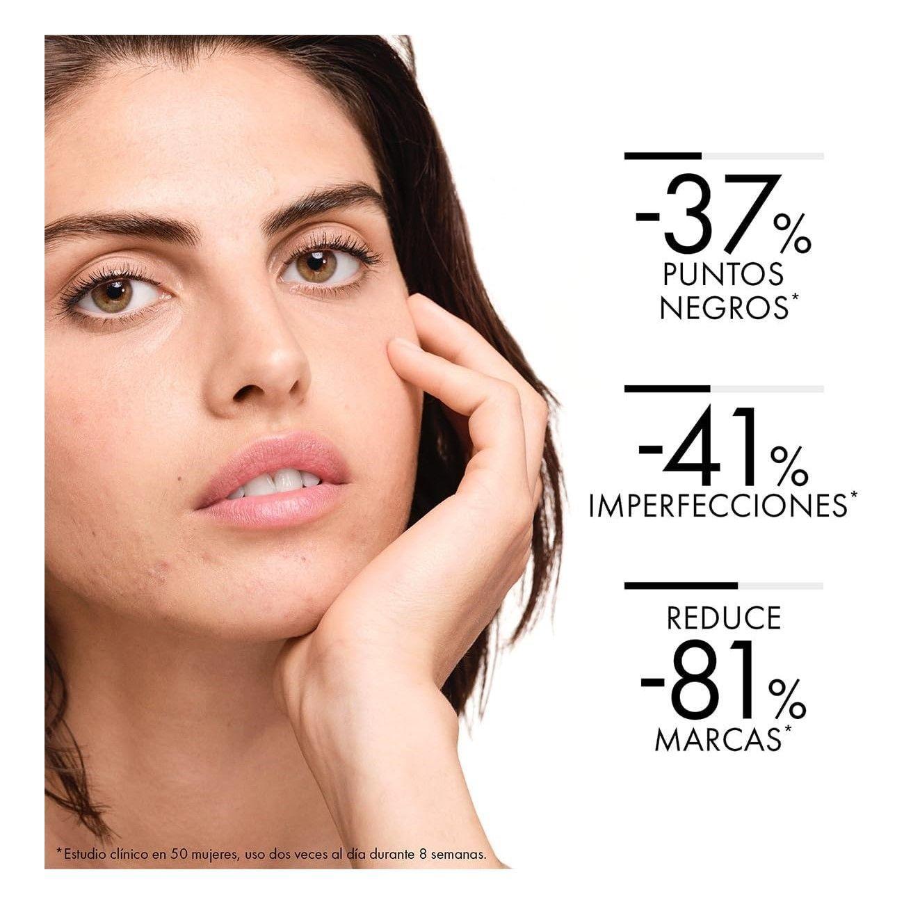 Tratamiento Anti-imperfecciones Vichy Normaderm 50ml-3