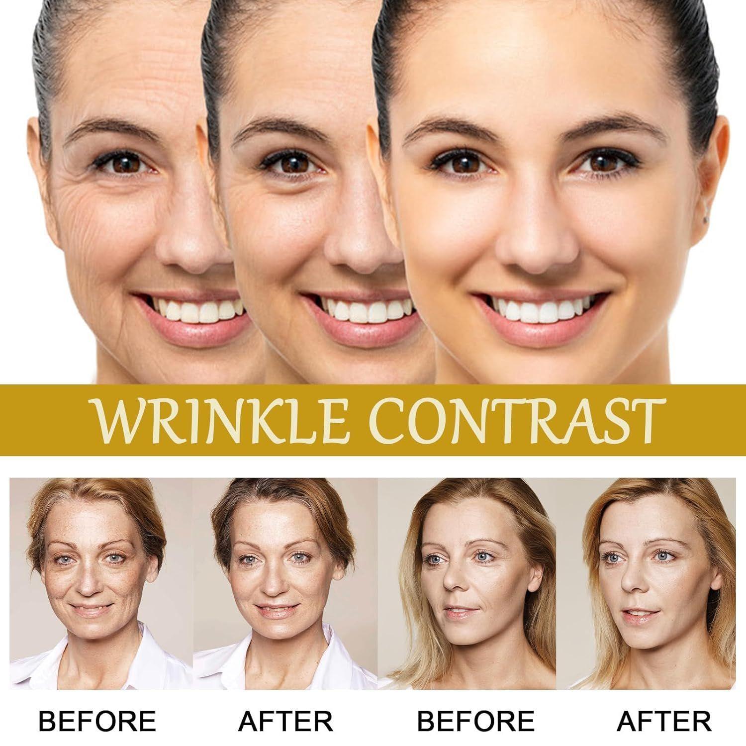 CREMA XHEKPON FACIAL EFECTO LIFTING + BOTOX BEE VENOM SERUM-5