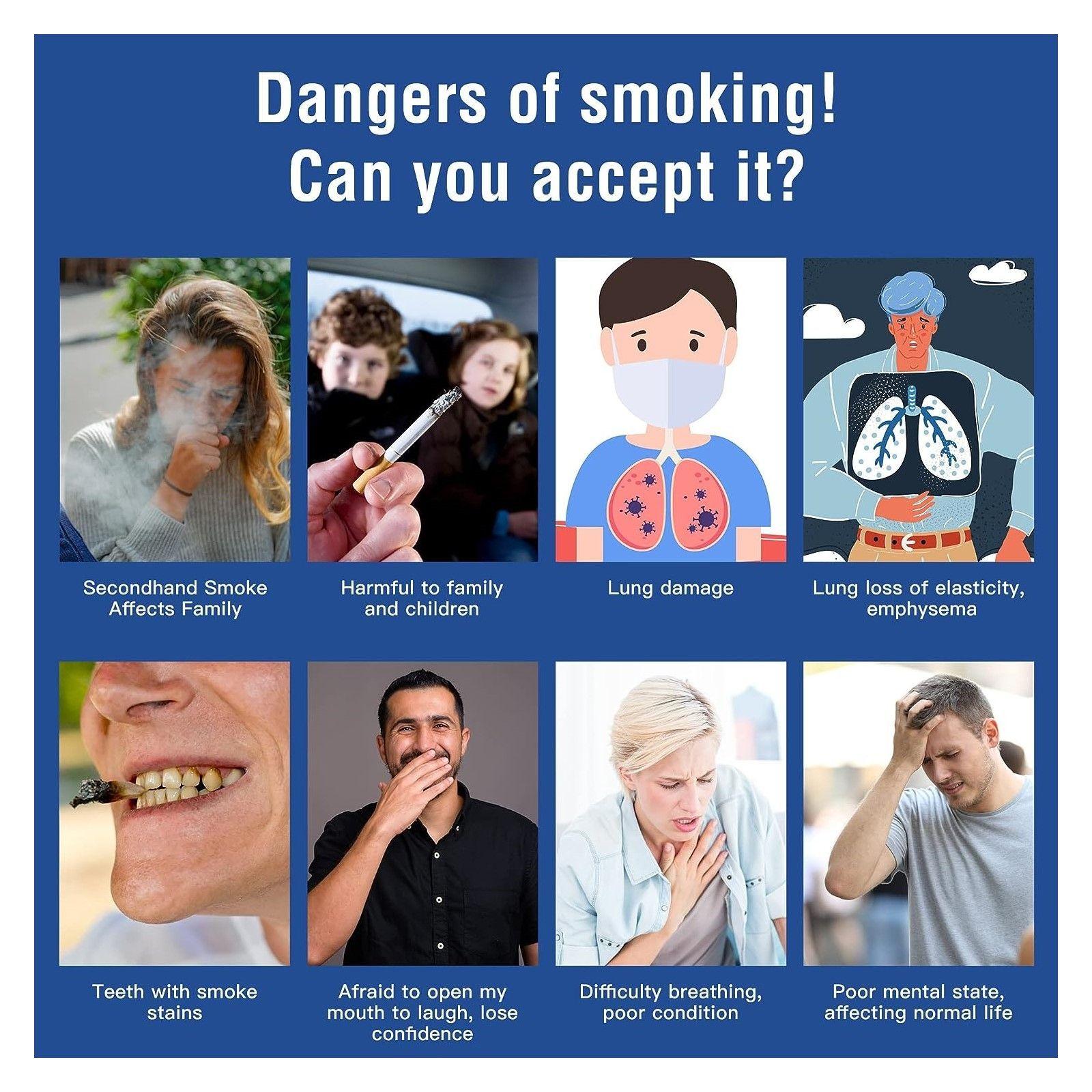 Parches Sorelax Cq 21mg Step 1 Para Dejar De Fumar 30 Unid-5