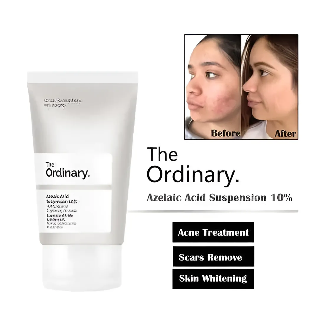 The Ordinary Azelaic Acid Suspension 10% Crema Antimanchas-4