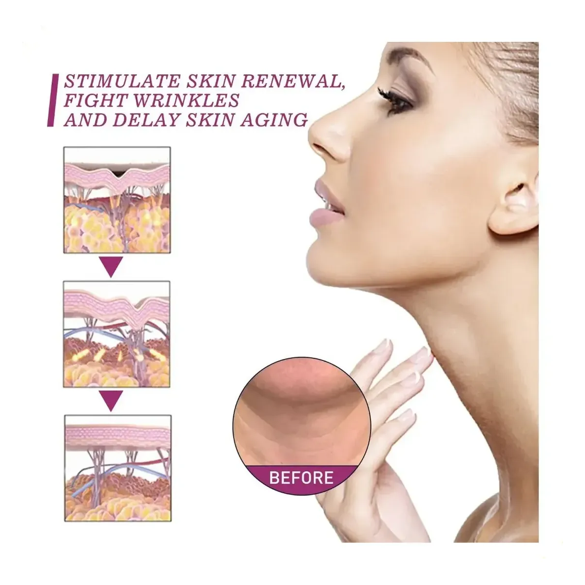 Crema Neckpon Cuello Efecto Lifting + Botox Bee Venom Serum-2