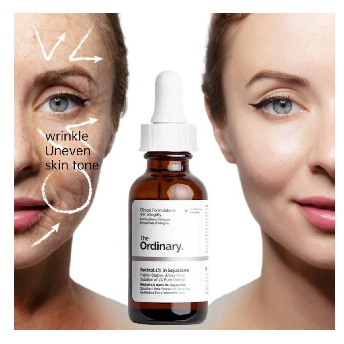 Serum The Ordinary Retinol 1% In Squalane Solucion 30ml-5