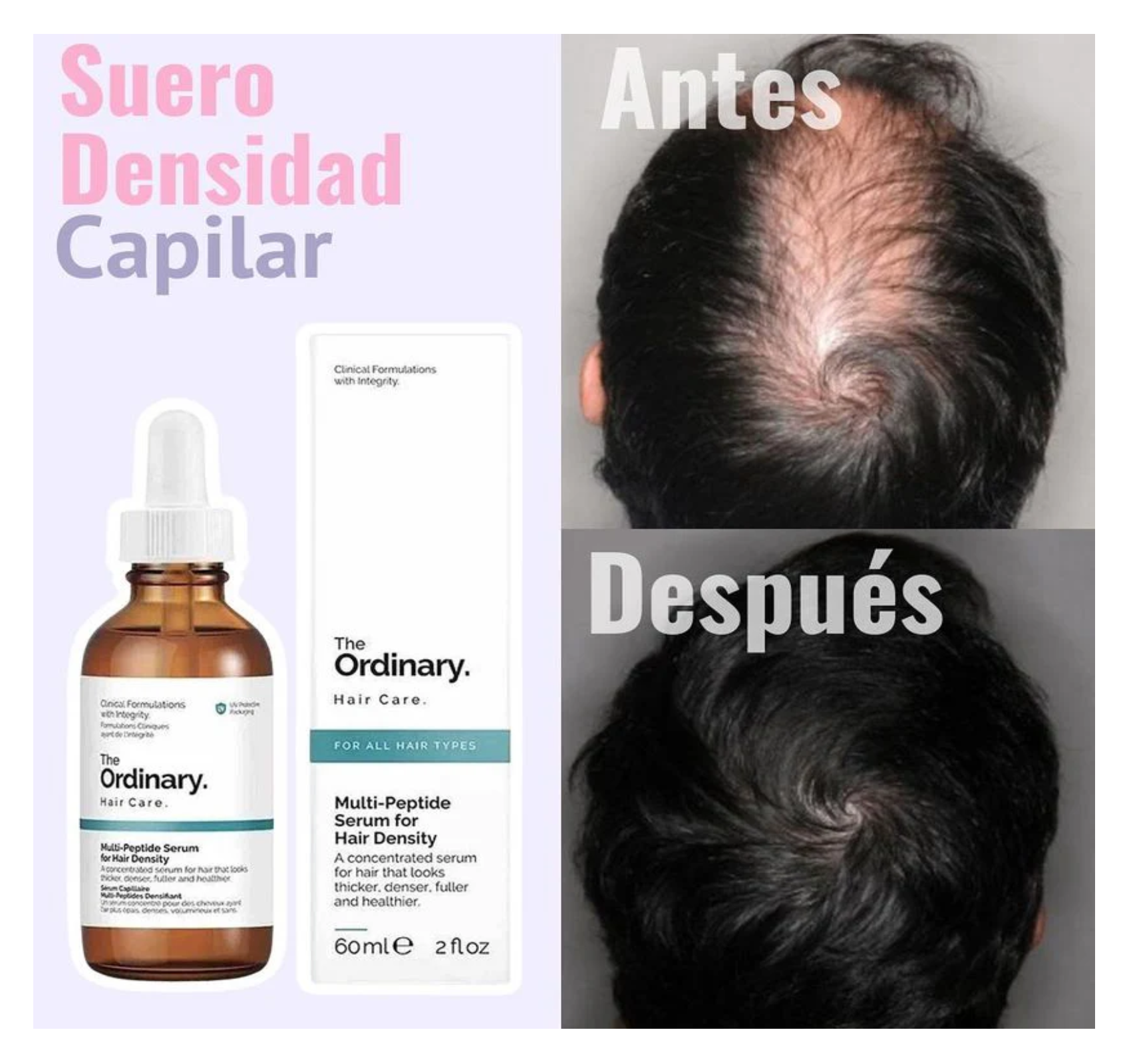 The Ordinary Serum Para Hacer Crecer El Pelo Evitar Su Caida-5