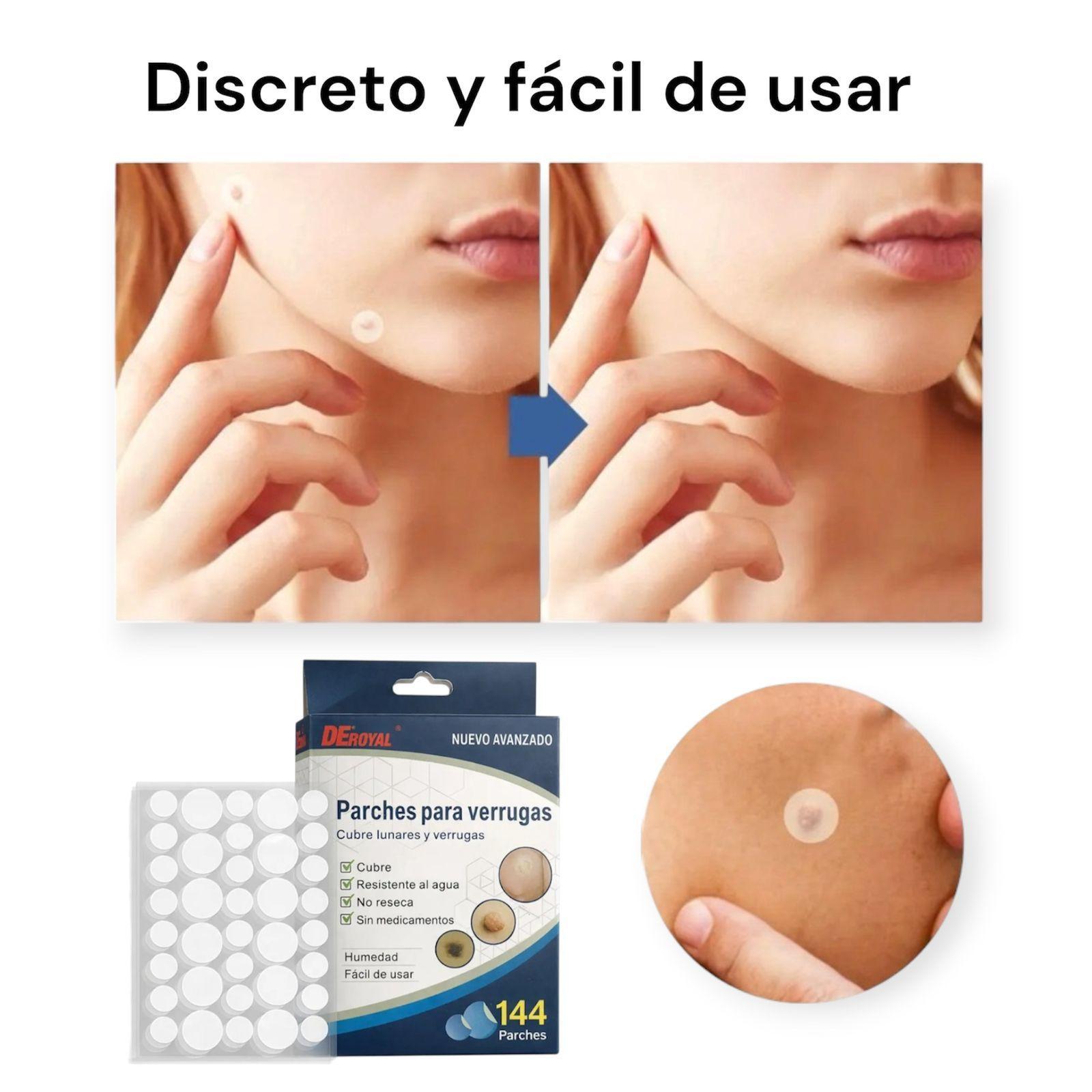 Parche Removedor de Verrugas Pack 288 Unidades-7