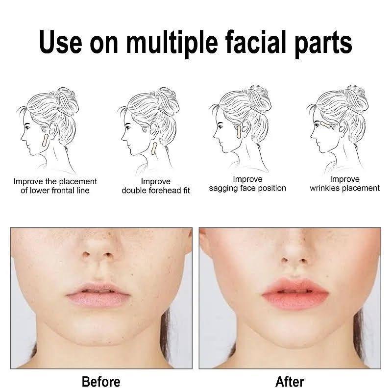 Lifting Estiramiento Facial Invisible Impermeable Autoadhesivo-4