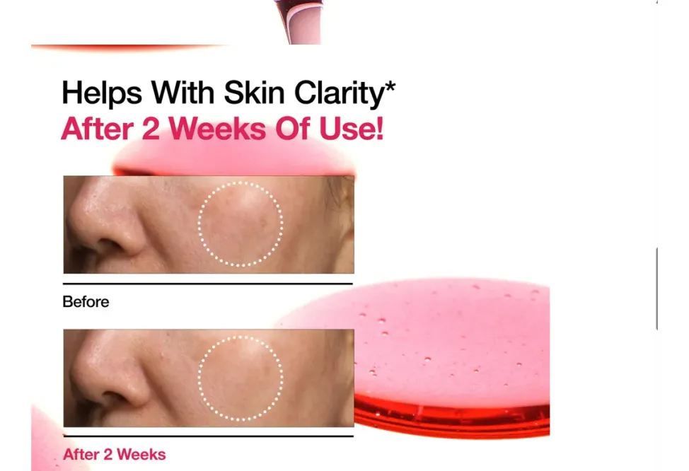 Anua Niacinamida 10% + Txa 4%: Reduce Manchas, Controla Brillos Y Unifica El Tono De Tu Piel-2