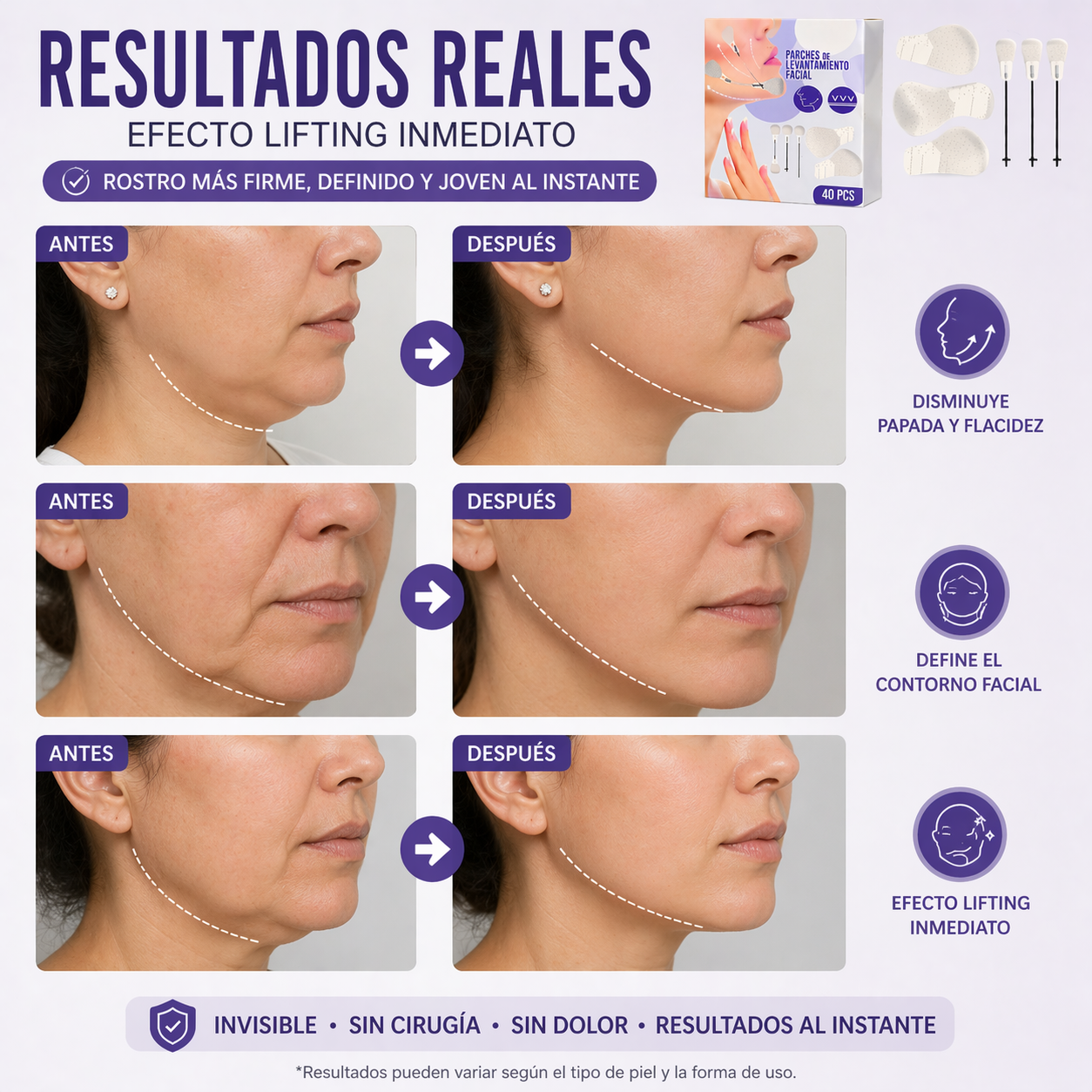 Parches De Levantamiento Facial Tensor Invisible 40 Pcs-4