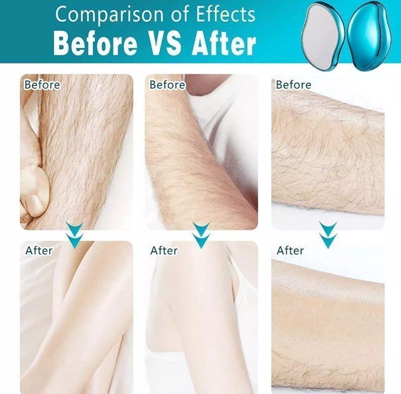 Depilador Cristal Exfoliador Vellos Removedor Sin Dolor Nano-4