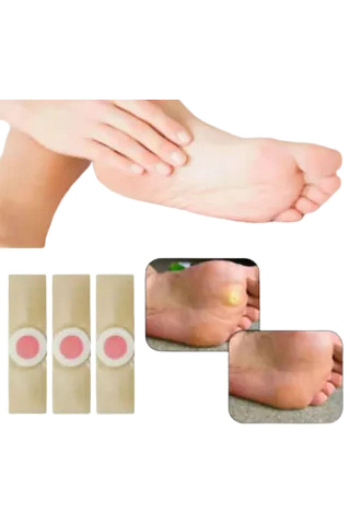 Pack 6 Parches Removedor Callos, Duricias, Hiperqueratosis-3