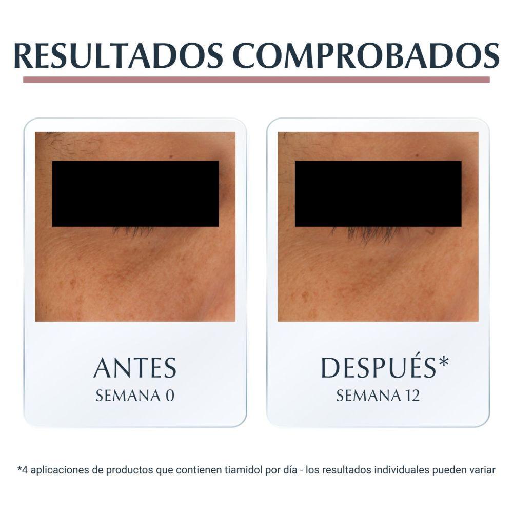 Crema Facial Anti-ojeras Anti-Pigment Eucerin 15mg-8