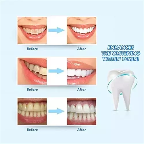 Blanqueador Dientes Instantáneo Blanqueamiento Dental Borax-6