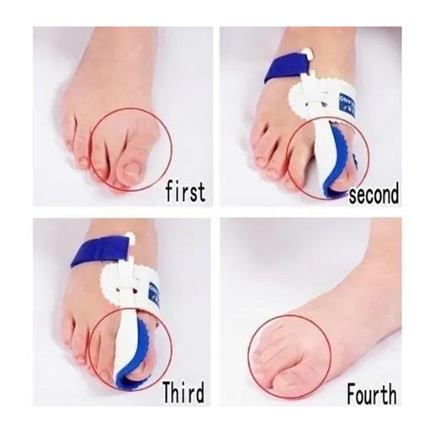 Corrector Juanetes , Ortesis Hallux Valgus-3