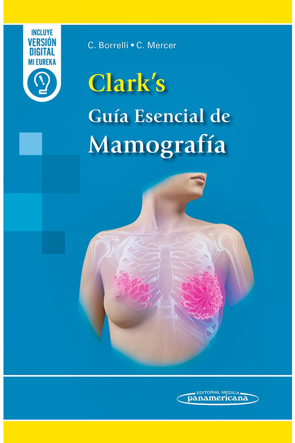 Clark's Guía esencial de mamografía-3