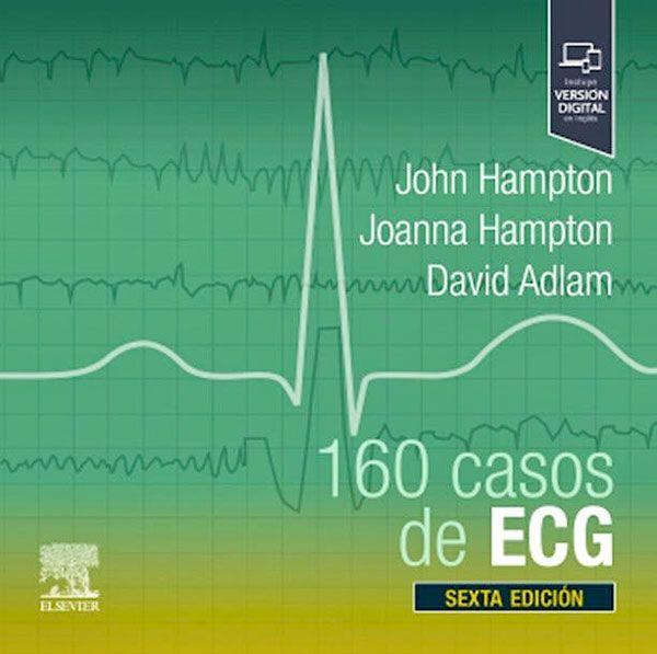160 casos de ECG de Editorial Elsevier-4