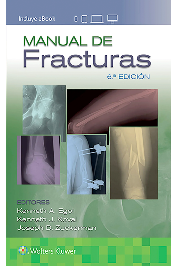 Manual de fracturas 6ª Ed.-3